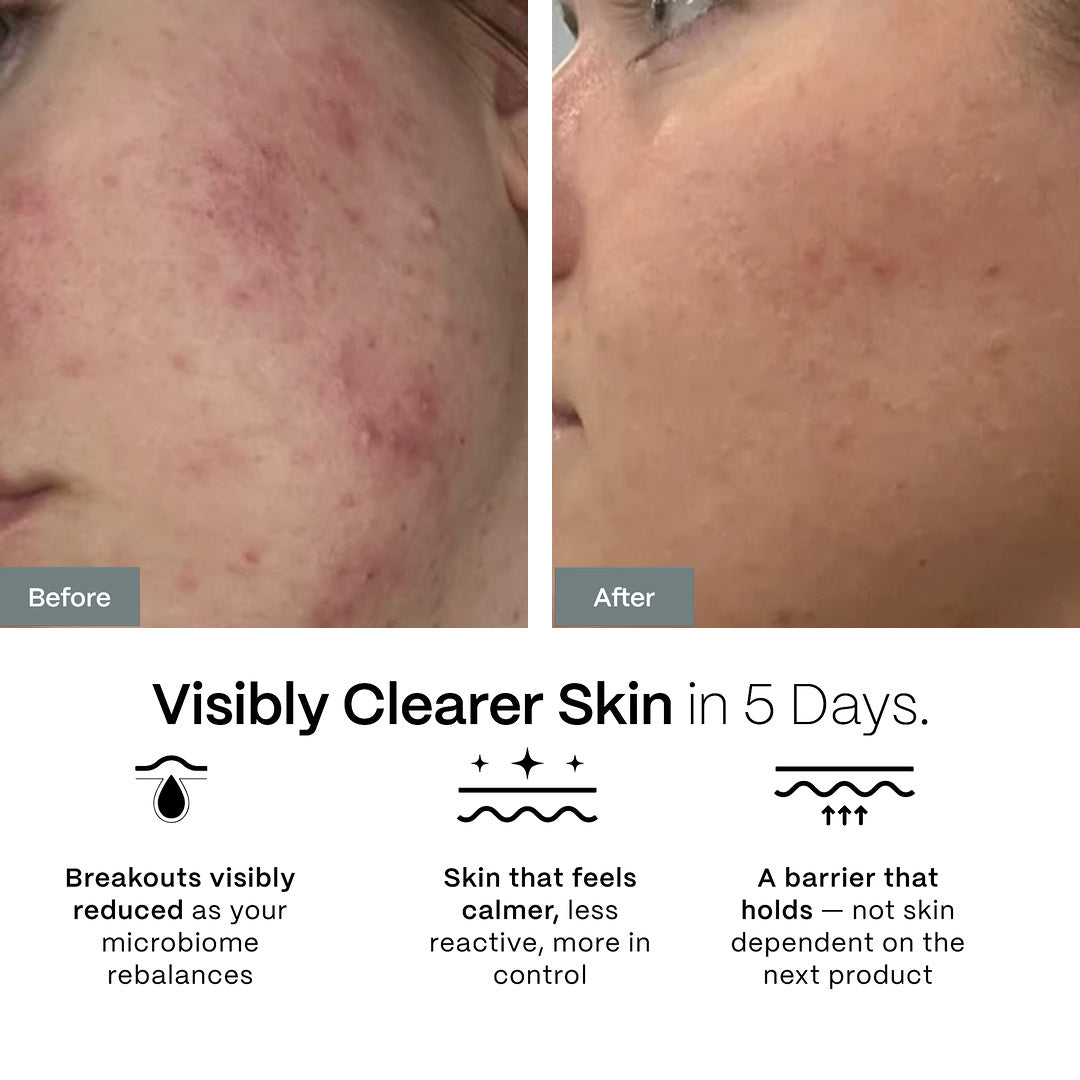 5-Day Rapid Results Kit Plus