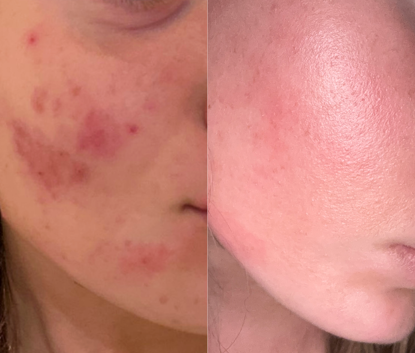 Hydrating Soothe Serum – Calm and Nourish Your Skin