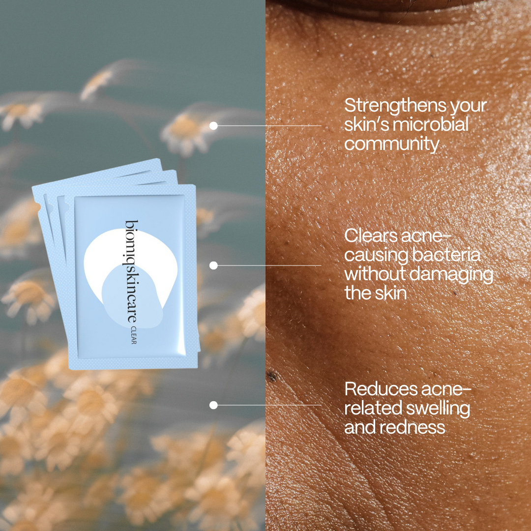 Clear Skin Acne Bundle - Your Complete Acne Solution